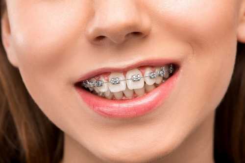 現代食物對牙齒健康有何影響？