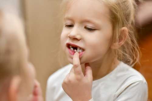 青春期牙龈炎的治療與預防(1)