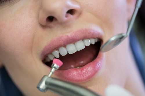 牙齒“黑三角”産生的原因？