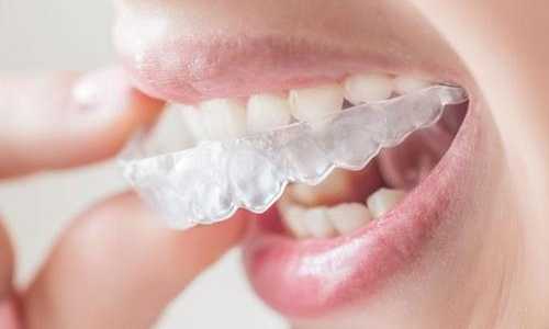 含氟牙膏真的能防航齒嗎？