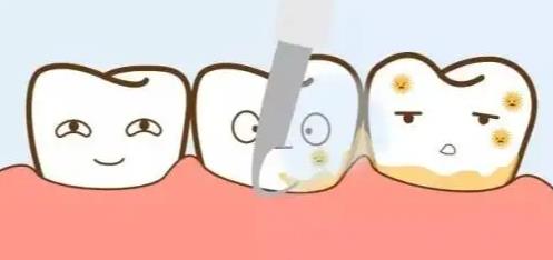 銀汞合金補牙的缺點？