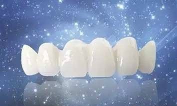 全瓷牙的“保質期”及其七大優勢，深圳全瓷牙