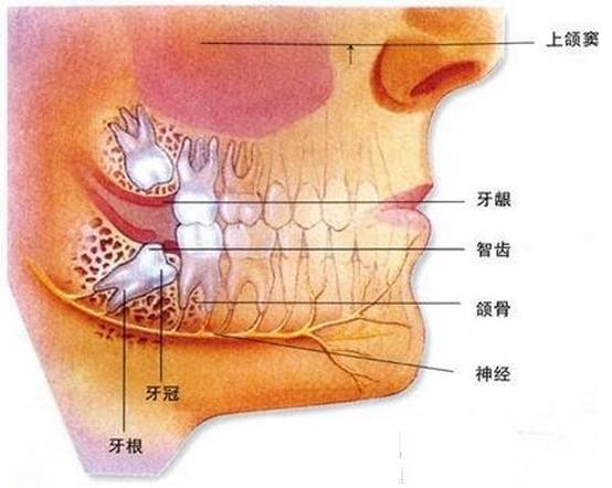 智齒嘅危害有咩？