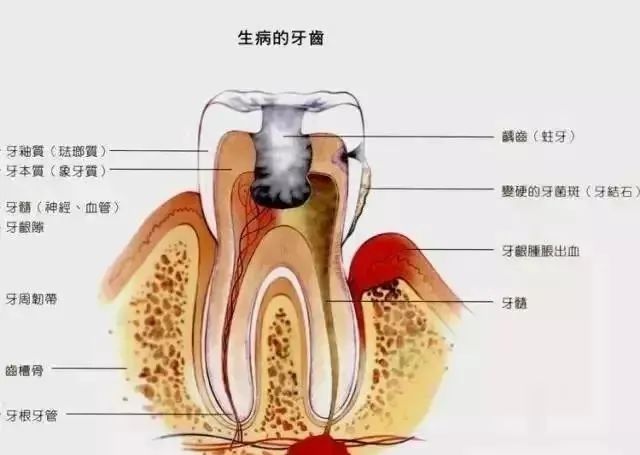 唔刷牙嘅人牙齒掉得快，仔細睇完就明白原因喇！