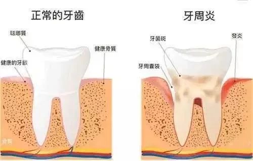 擁有口腔問題嘅“百科全書”，居家隔離遠離口腔疑難。