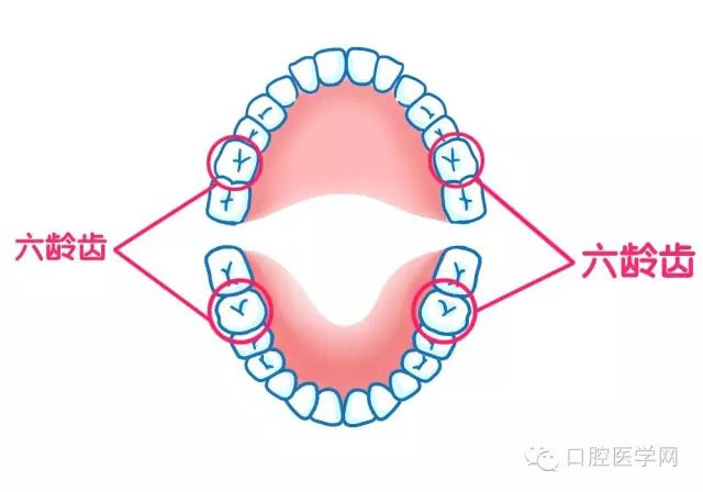 咩係六齡齒，點保護孩子六齡齒？