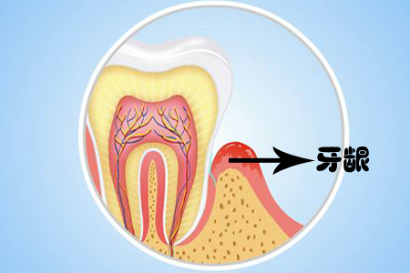 牙齦萎縮嚴重是怎麼回事？只覆蓋牙齒的根部了