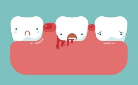 刷牙經常會出血，但洗牙一段時間，刷牙就不會