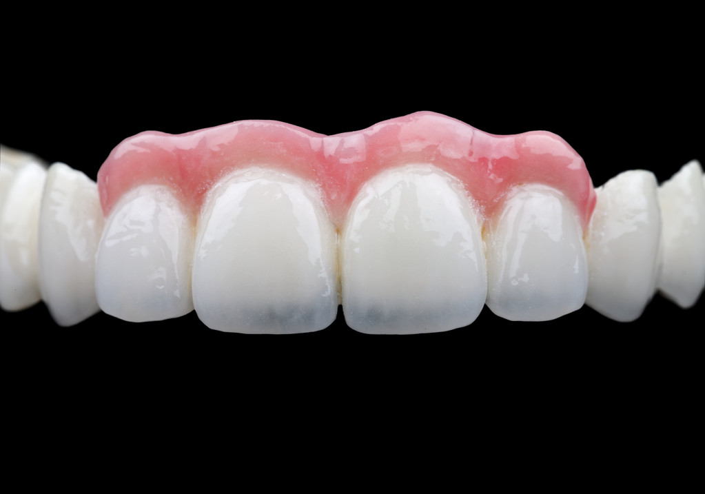 牙醫叫您選擇二氧化鋯全瓷牙，是有原因滴
