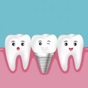 維港牙醫介紹詳細的種牙治療步驟