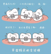 牙齒矯正後如何保養？
