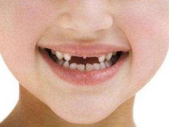 小孩子拔牙後吃什麼止疼藥？