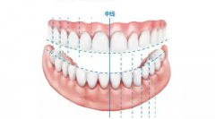 牙齒的三大功能之一：美觀功能