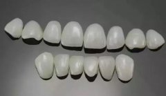 效果持久的牙齒美容方式---全瓷貼面