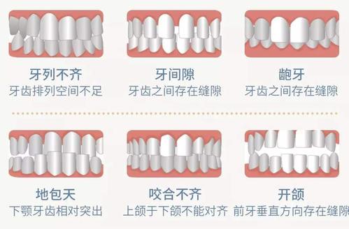 牙齒問題