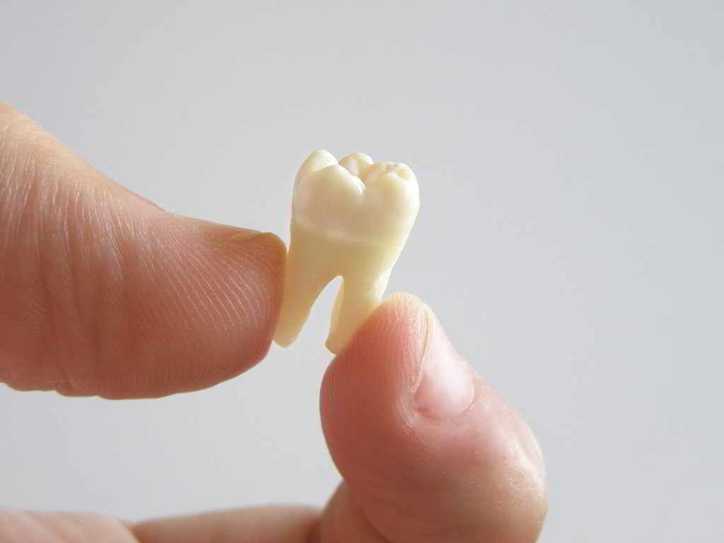 牙齒疼痛有十幾種方式，你是哪種痛？